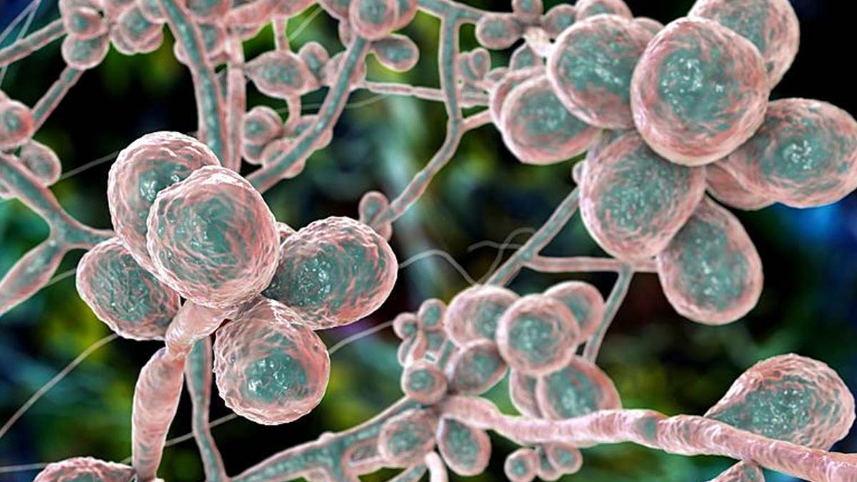 Scientists Warn Of Evolving Deadly Fungal Infections Leading To A “Silent Pandemic”